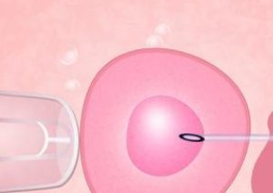 2026年想去池州市做试管婴儿需要准备哪些事？详细收费明细一览